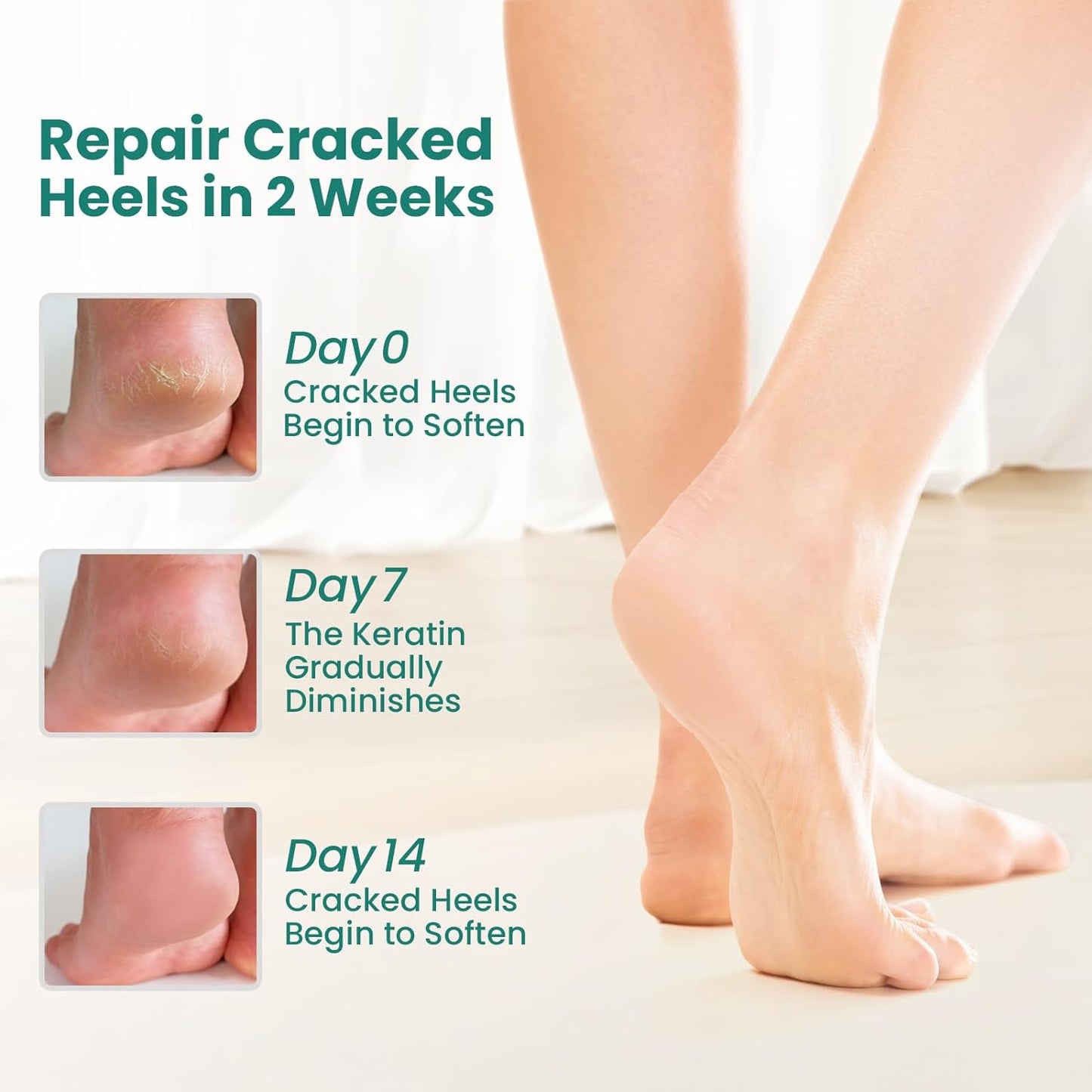 Moisturizing Gel Heel Socks