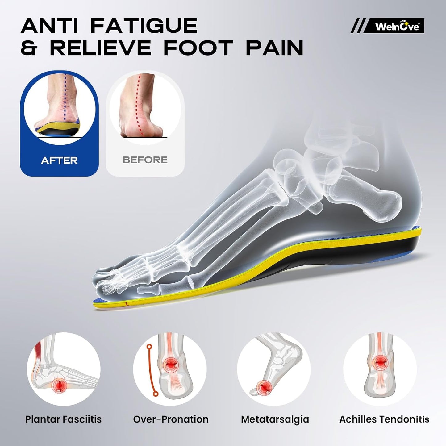 Active Running Sport Insoles