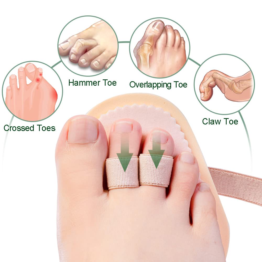 Toe Splint