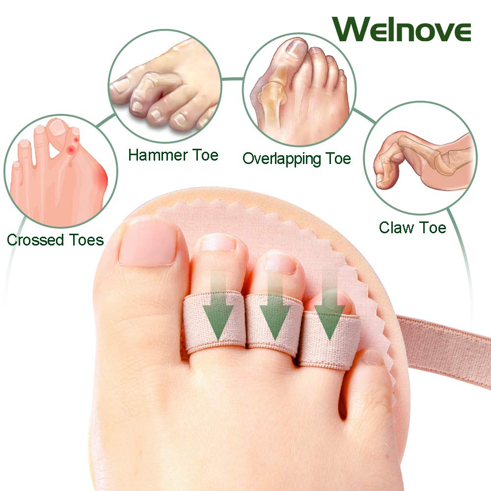 Toe Splint