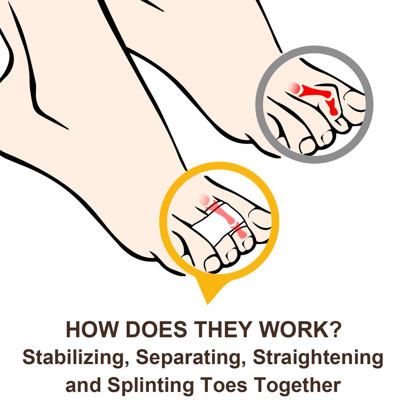 Hammer Toe Straightener
