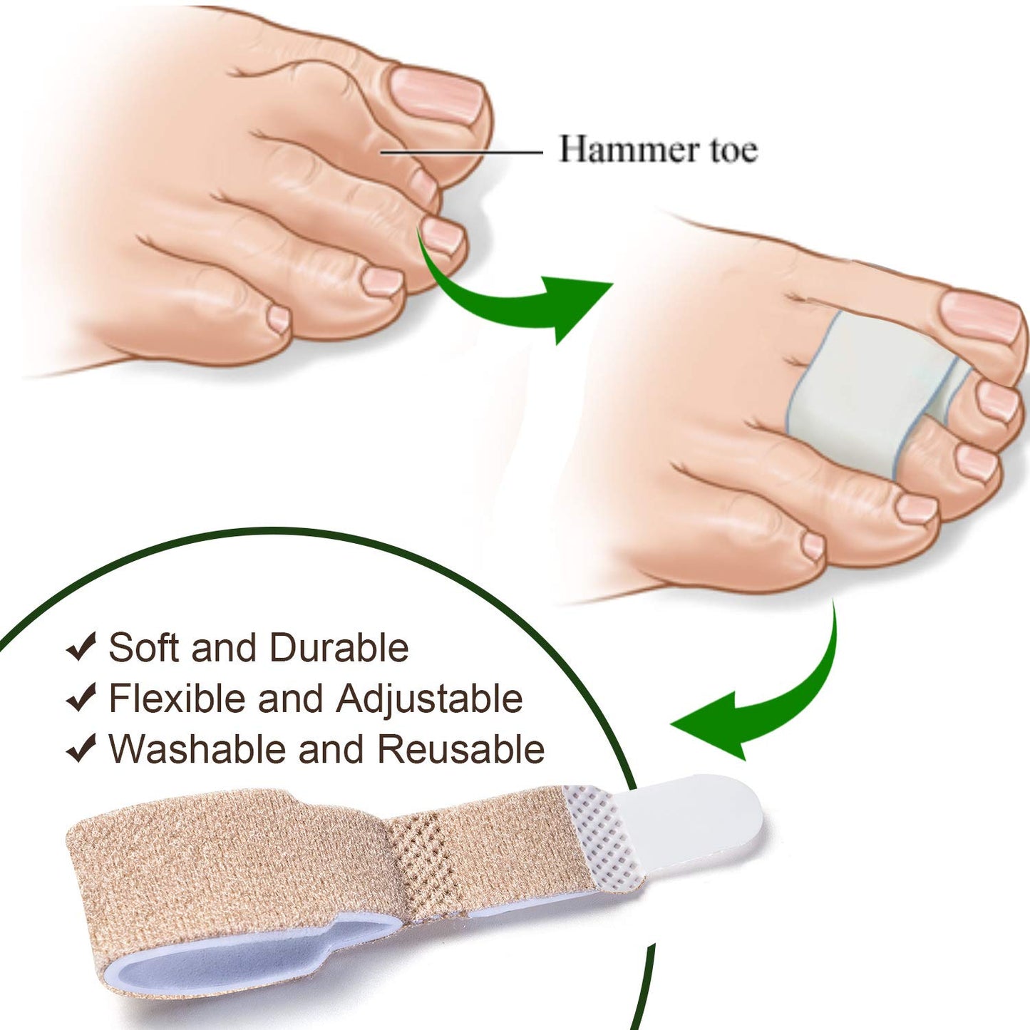 Hammer Toe Straightener