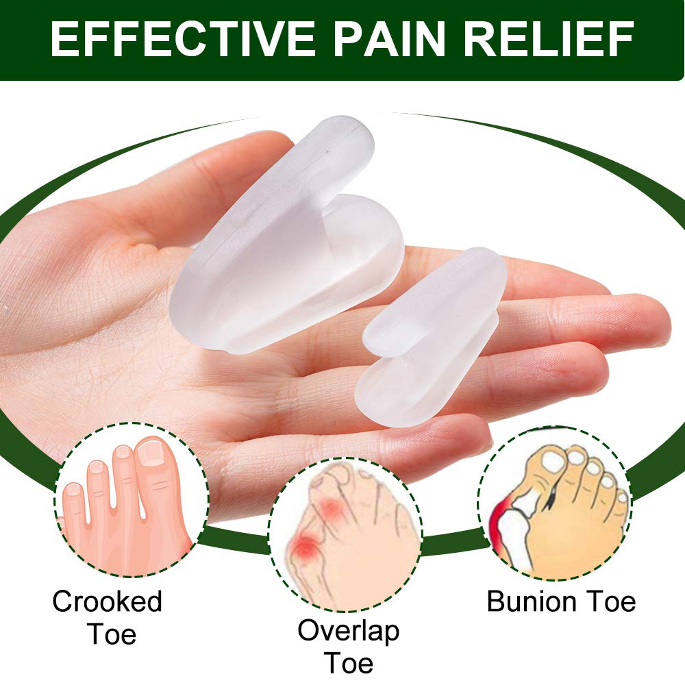 Toe Separators for Bunions