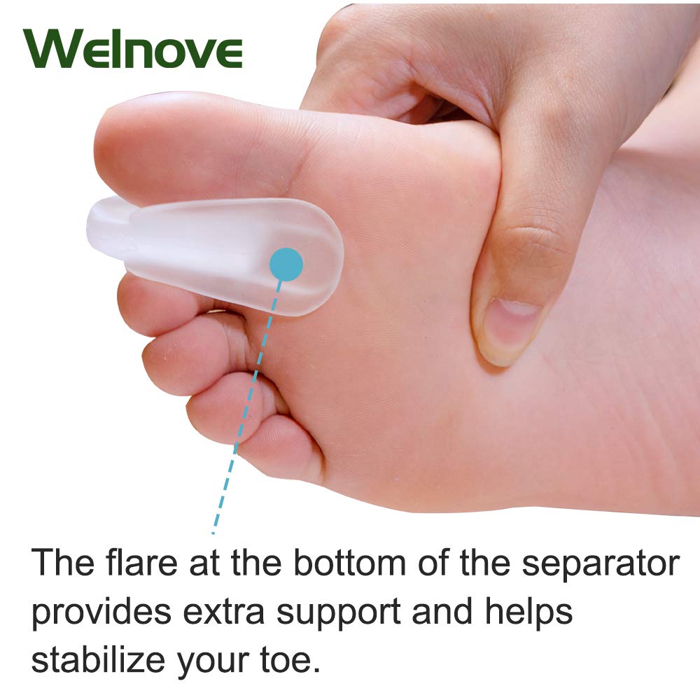 Toe Separators for Bunions