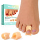 Hammertoe Corrector - 6 Pack (Beige)