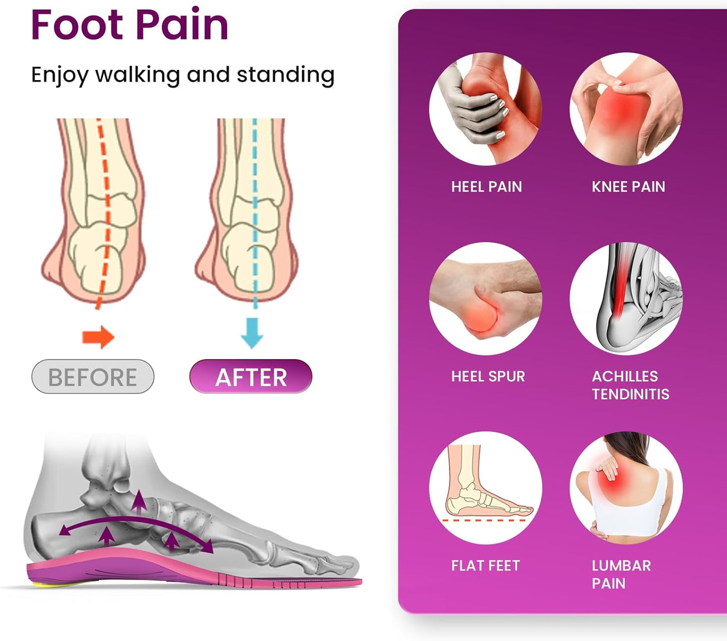 Welnove Metatarsalgia Insoles